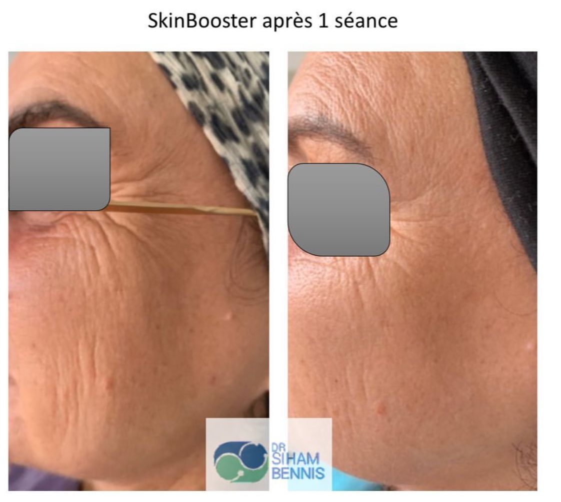 Transformation 2 - Dr. Siham Bennis
