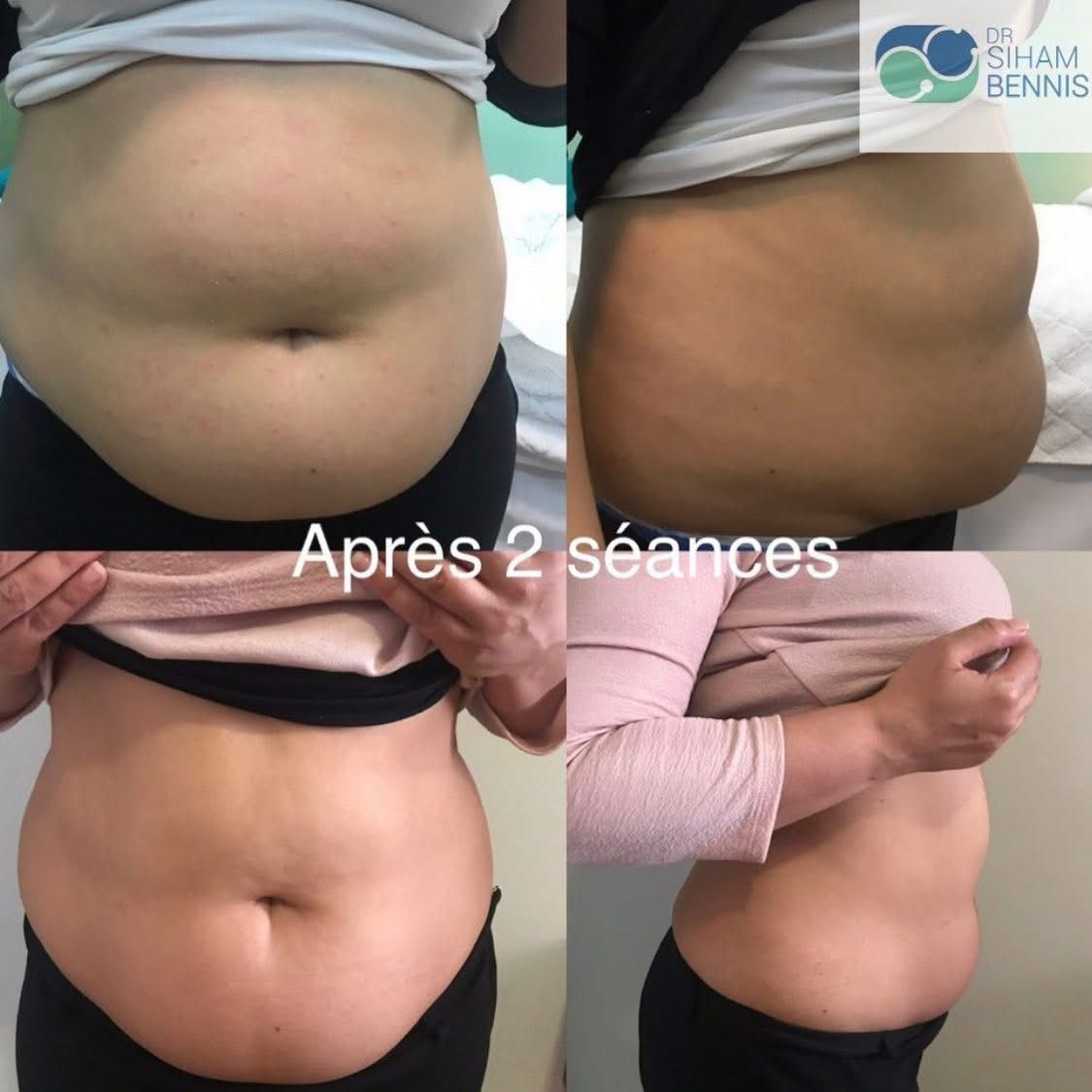 Transformation 7 - Dr. Siham Bennis