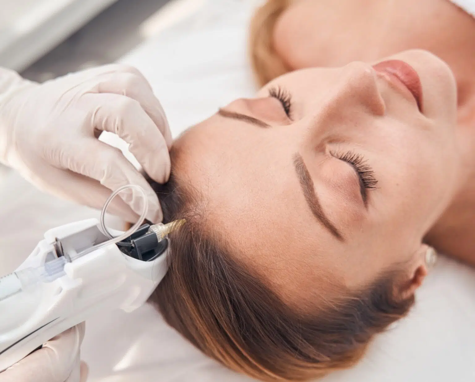 Résultat traitement cheveux